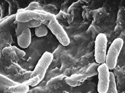 Bacteria can be both beneficial or harmful