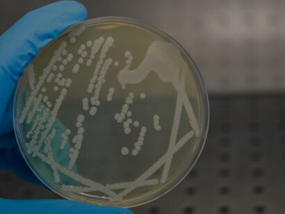 A hand holding a petri dish with isolated bacterial colonies in a bacteriological laboratory's laminar flow cabinet