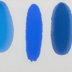 Antonio Scaccabarozzi, Iniezioni endotela - cm cubi 8, 1980, iniezione endotela, 42x102 cm. Courtesy Archivio Antonio Scaccabarozzi. Tutti i diritti riservati