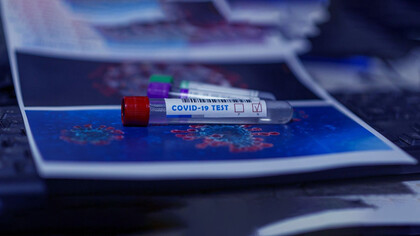 Da oltre 9 mesi SARS-CoV-2 ha corrisposto alle due definizioni base di pandemia 