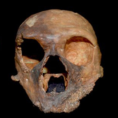 Cranio di Homo neanderthalensis