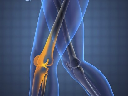 L'osteoporosi riguarda soprattutto le ossa lunghe