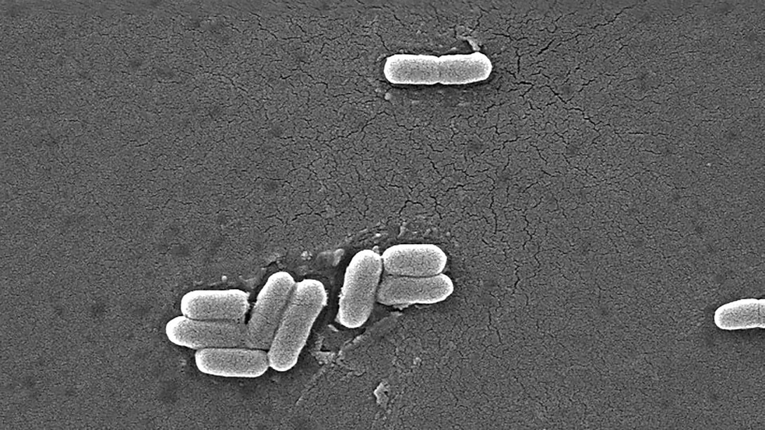La célèbre Escherichia coli, hôte de nos intestins. Inoffensive le plus souvent, elle contribue à la digestion de nos aliments, mais quelques souches peuvent s’avérer pathogènes et dangereuses