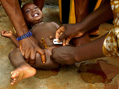 Infibulation. Aujourd'hui encore, ces rituels tribaux violents ne reçoivent que peu d'attention de la part de la majorité des populations du monde et, surtout, les véritables méthodes exécutives et les photos de l'intervention, dont la diffusion se fait principalement par des revues médicales, sont peu connues