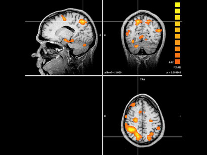 Respuesta de la amígdala y el córtex prefrontal frente a estímulos negativos