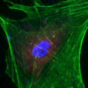 Las células madre son una herramienta valiosa para tratar condiciones como la diabetes, enfermedades cardíacas y trastornos neurodegenerativos