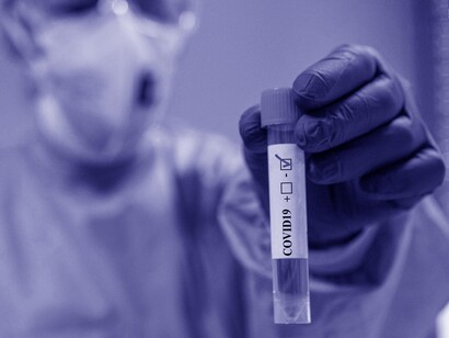 Covid is a call for further interdisciplinary public health development as an instrument for universal public good