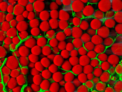 Fat cells