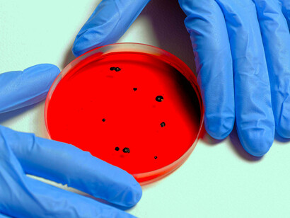 Scientifique avec verre de Petri. Une bactérie dite de souche sauvage n'a besoin pour se multiplier que d’une source de sucre dans un bouillon de culture convenablement dosé en sels minéraux