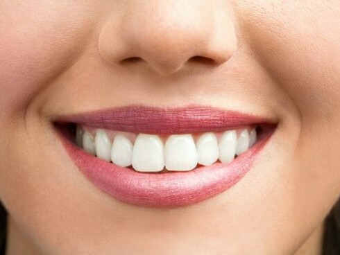 A woman smiling. Dental scaling may require multiple visits, each addressing a different area of the mouth