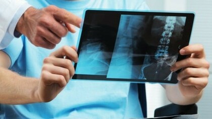 Un médico revisa con su paciente una radiografía