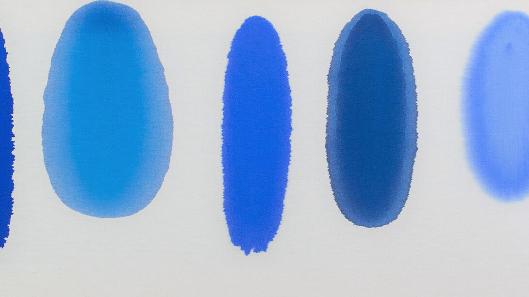 Antonio Scaccabarozzi, Iniezioni endotela - cm cubi 8, 1980, iniezione endotela, 42x102 cm. Courtesy Archivio Antonio Scaccabarozzi. Tutti i diritti riservati