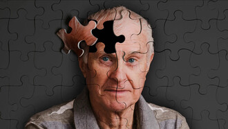 Representación gráfica de un hombre mayor con Alzheimer