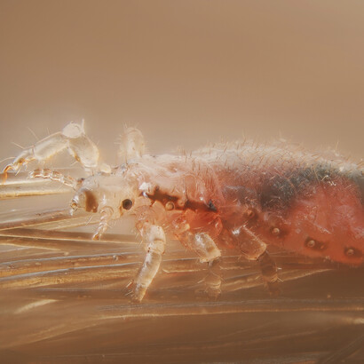 Lice are obligate parasites, living externally on warm-blooded hosts