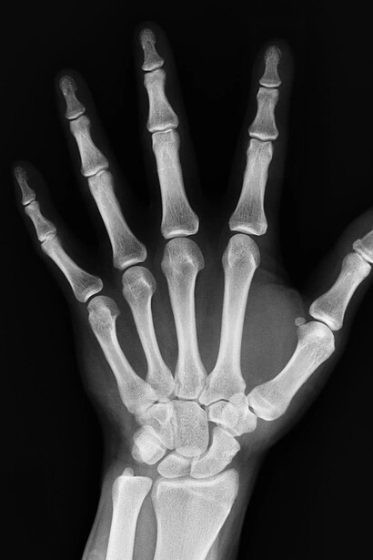Ossa delle mani viste sotto i raggi X