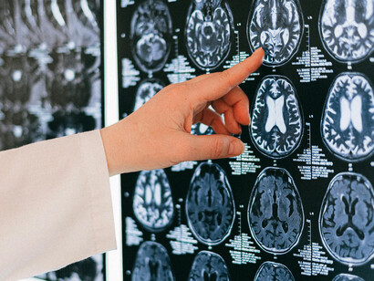 A doctor pointing to a brain scan