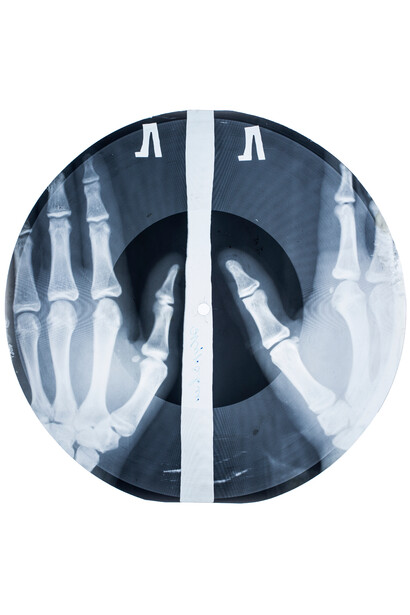 Soviet Music ‘On the Bone’ Vinyl Record, Copy on Medical X-Ray Fluorography, Sheet, 1950s–1960s, Courtesy Stephen Coates and Paul Heartfield, X-Ray Audio