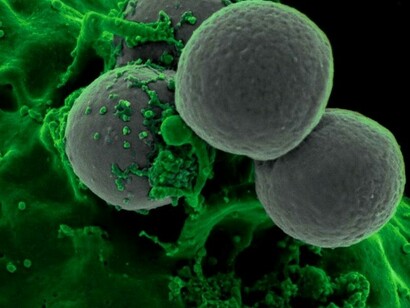 Persino la più ampia indagine genetica  è riuscita a ricostruire solo in parte la tempistica delle epidemie che si sono susseguite nel tempo