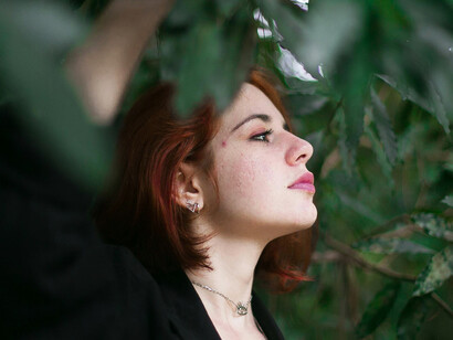 La piel clara, característica de los pelirrojos, les permite producir vitamina D en climas con poca luz, pero aumenta el riesgo de cáncer de piel en regiones con alta radiación UV