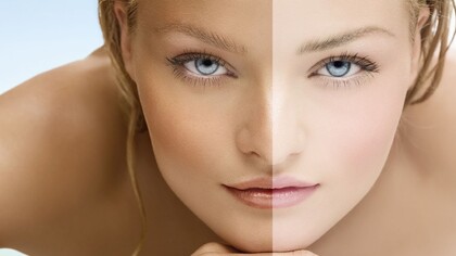 Antes y después de un tratamiento para blanquear la piel