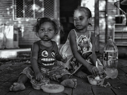 Every 5 seconds a child dies from malnutrition and hunger