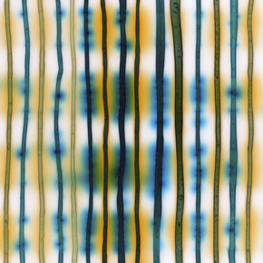 Jaq Chartier, Lines with turquoise and gold (detail), 2026. Courtesy of Dolby Chadwick Gallery 