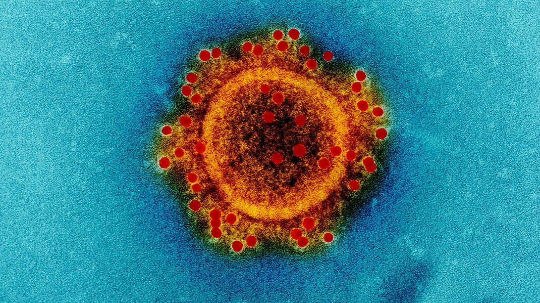 Imagen ampliada y coloreada digitalmente de un virión de una cepa de coronavirus (MERS-CoV)