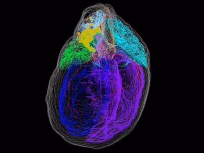 Mapa de el sistema neuronal del corazón