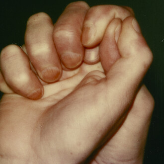 Hannah Villiger, Work, 1980. Courtesy of Meredith Rosen Gallery