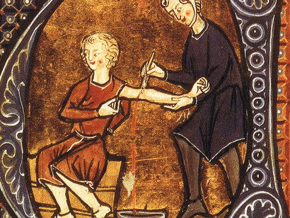 Un salasso in epoca medioevale