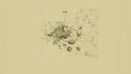 Riproduzione dell'aspetto microscopico del materiale ateromatoso nelle tavole del libro di Jiulius Vogel "Icones Histologiae Pathologicae", 1843