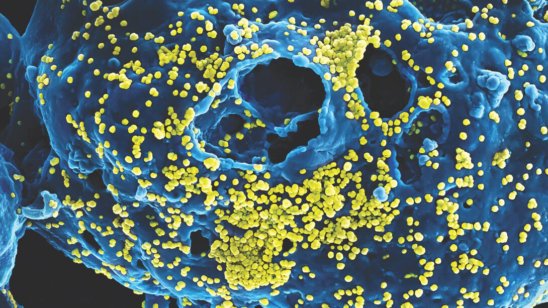 Outbreak: Epidemics in a Connected World. Courtesy of Smithsonian's National Museum of Natural History