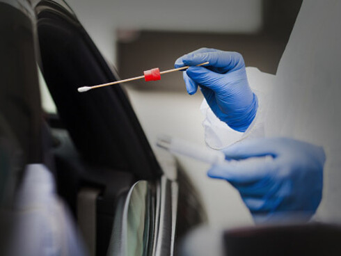 Nearly half the population suffers from 1 and more co-morbidities which makes getting any infection, Covid-19 included