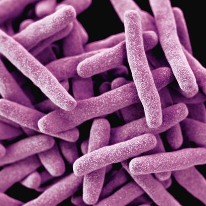 «Mycobacterium tuberculosis» o bacilo de Koch
