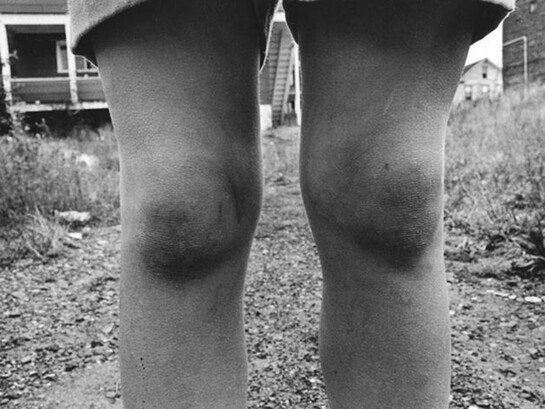 Bubblegum. 1975, 16 x 20 inch gelatin silver print  