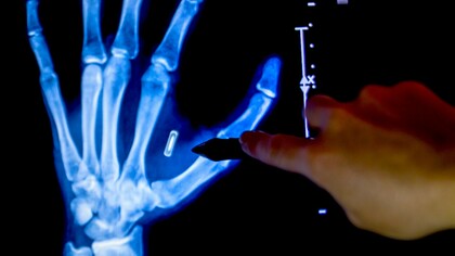 Mondex, o microchip da marca da besta?