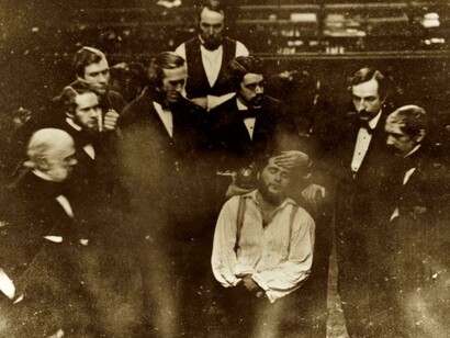 Los tiempos heroicos de la anestesia quirúrgica