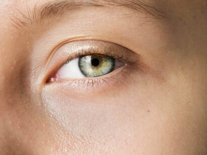 La dacriocistorrinostomía mediante láser (DCR), es una técnica por la que se crea un nuevo canal para el drenaje lagrimal mediante láser, de forma menos invasiva que la cirugía convencional, a partir de un abordaje externo