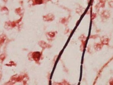 Une bactérie qui produit des spores dormantes