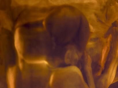 De la Serie «Ser, tiempo, espacio» (2003), cibachrome. 20 x 30 cm. Imagen cortesía del artista