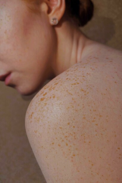La psoriasi infatti denota un blocco espressivo
