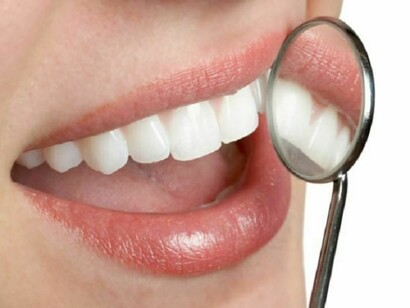 White teeth normally mean dental health 