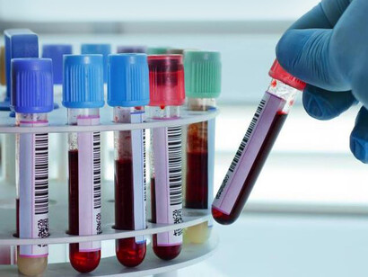 È ancora da determinare l’effettivo valore clinico incrementale dei DI rispetto alla terapia tradizionale