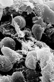 Questa immagine raffigura il batterio della peste visto al microscopio
