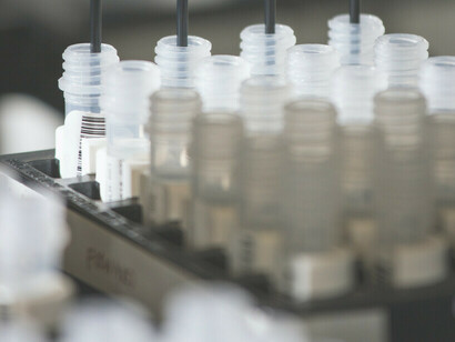 Uma seleção de amostras de DNA para amplificação no laboratório de pesquisa genômica do câncer