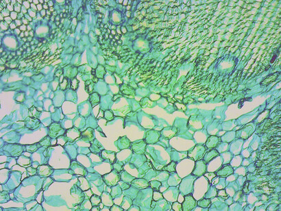 Células humanas vistas bajo el microscopio