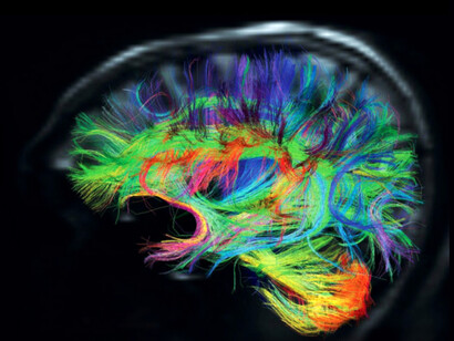 Los principales avances en la detección de mentiras desde el enfoque de la neurociencia cognitiva se desarrollan a partir de lo que se ha venido a conocer como «carga cognitiva»