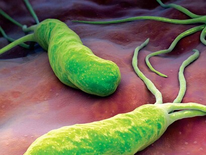 Helicobacter pylori