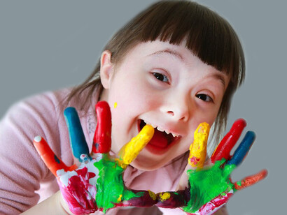 En una primera investigación se comenta sobre que las personas con síndrome de Down que acudían al hospital mostraban síntomas más severos que la población de similar edad, discutiéndose en el mismo los motivos de que se produzca esta relación