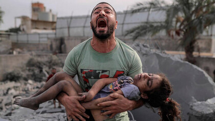 Un padre desesperado pide ayuda para salvar la vida de su hija víctima de los bombardeos en Gaza